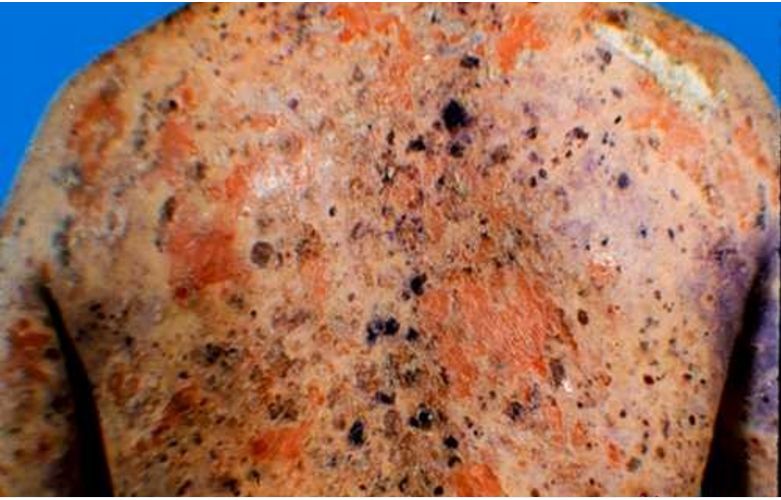 �՚�ؓ�x�ӌ�Ƥ�w���д_�Я�Ч