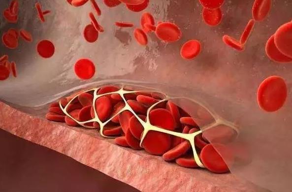 һ�N��Ч�{�����w֬��x�����|�����՚�ؓ�x��